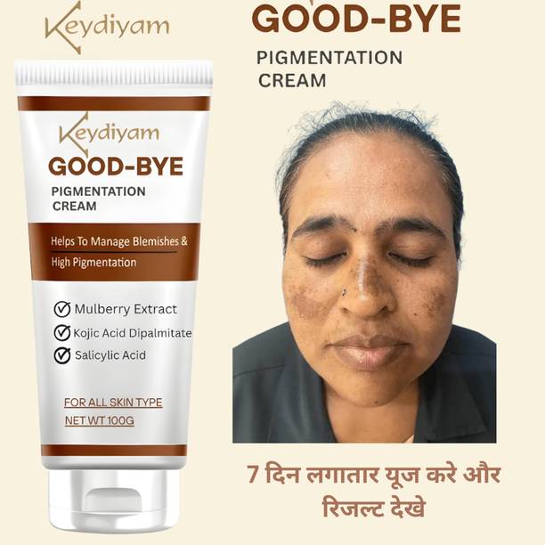 DRIDDLE Pigmentation removal cream for women Acne Scar Removal Dark Spots Stretch Marks