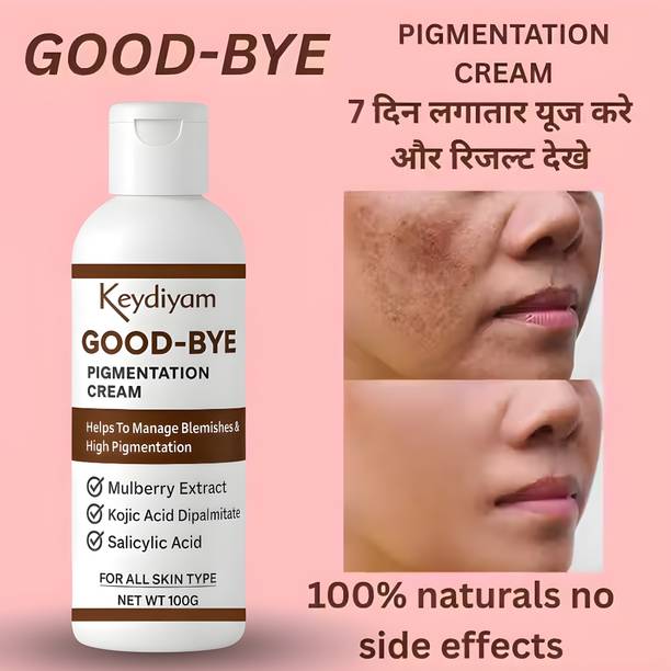 keydiyam Pigmentation Cream for Acne Scar Removal Pigmentation Dark Spots