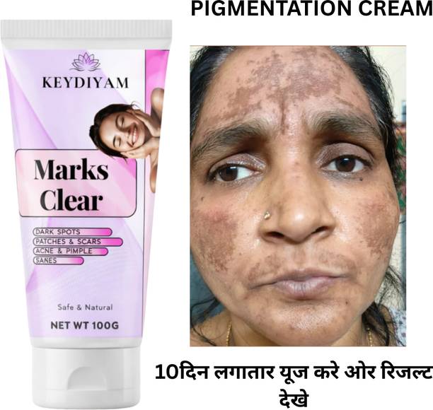 keydiyam Dark Spot Remover for Face, Dark Spot Corrector Cream