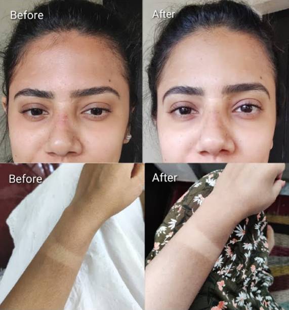 FRAILENO Body Tan Removal Cream for Men & Women | De-Tan Face & Full Body -2