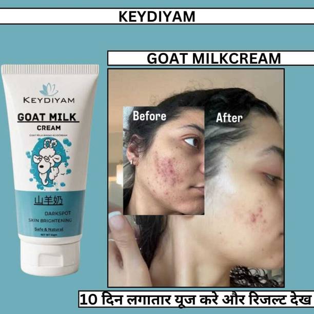 keydiyam Dark Spot Remover for Face, Dark Spot Corrector Cream