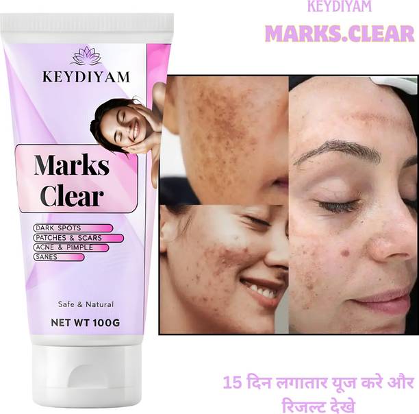 keydiyam Dark Spot Remover for Face, Dark Spot Corrector Cream001