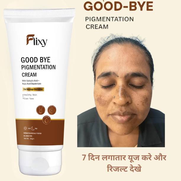 FLIXY Pigmentation removal cream for women Acne Scar Remover Dark Spot Strech mark