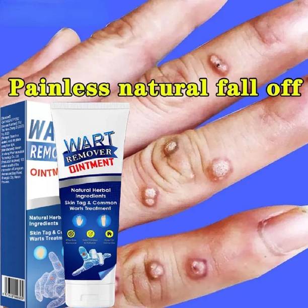 manasona Wart remover cream for wart removal