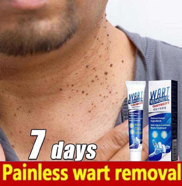luzimaisa wart remover cream