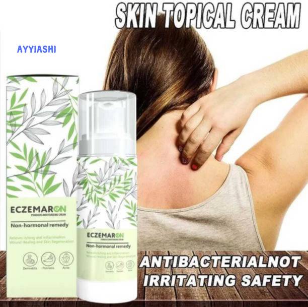 AYYIASHI Eczemaron Anti Fungal Advanced Formula Cream For Tough Fungal Issues
