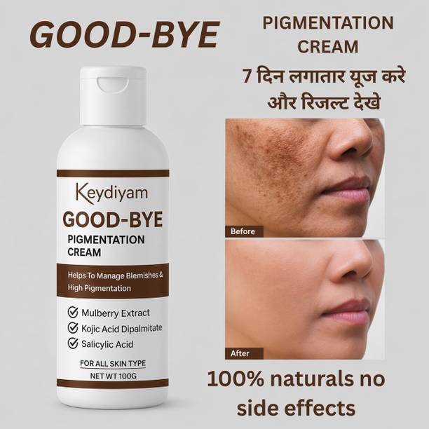 keydiyam Pigmentation Cream for Acne Scar Removal Pigmentation Dark Spots 100g