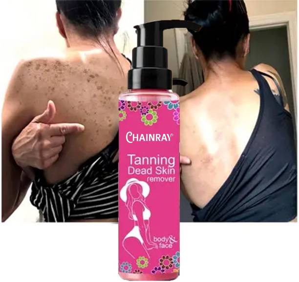 Qwera Tanning remover 100% Natural Dark Spots Hyper Men & Women