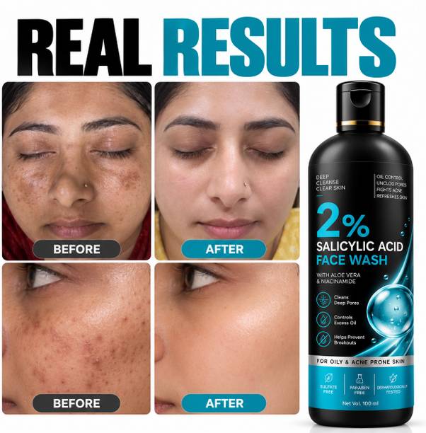 Wxz 2% Salicylic Acid  Oil Control Deep Cleansing for Acne Prone Skin Face Wash