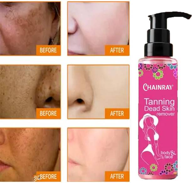 Qwera Tanning remover 100% Natural Dark Spots Hyper Pigmentation Men & Women