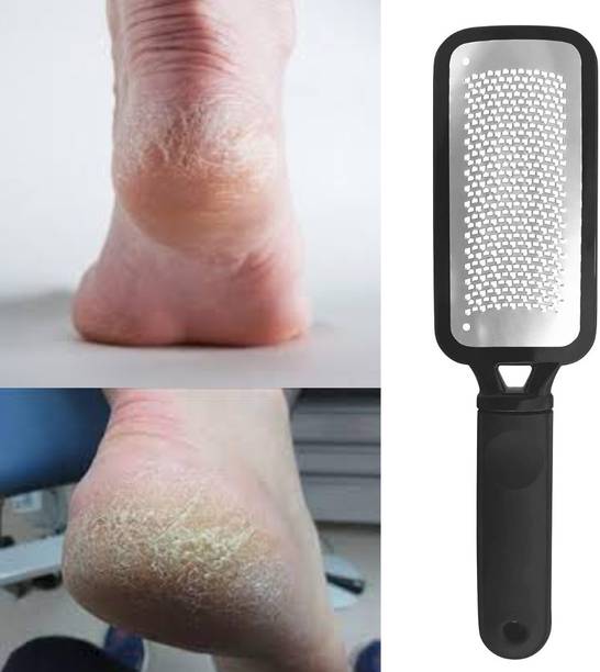 SIYDHA Foot Scrubber Lifelong Hard Pedicure Tool For Dead Skin Feet Cleaner {Steel}