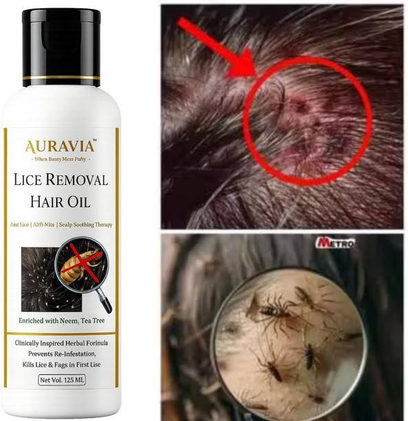 AURAVIA Lice Removal Hair Oil with Natural Herbal Ingredients Hair Oil