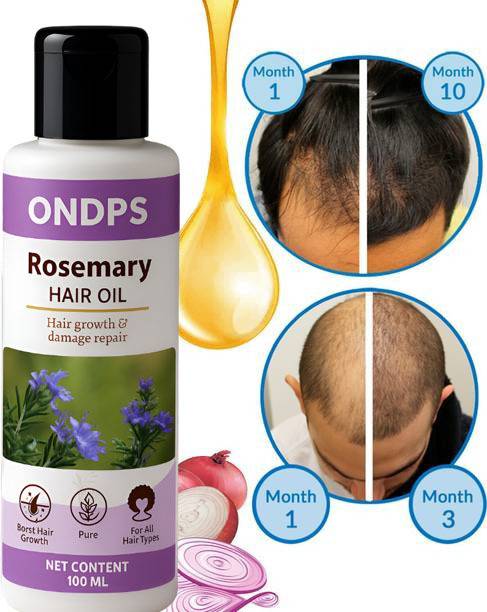ONDPS Rosemary Hair Oil for hair fall| 100% Ayurvedic Oil for Men & Women  Hair Oil