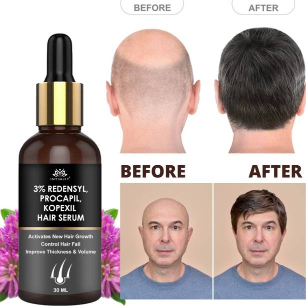 INTIMIFY 3% Redensyl Hair Growth Serum For Hair Fall Control, Delays Hair Greying 30 ml Hair Oil