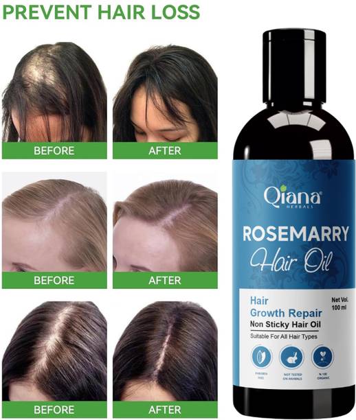 Qiana Rosemary Essential Oil, 100% Pure Oil for Hair Growth Hair Oil