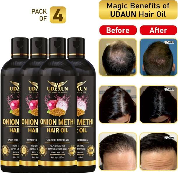 Udaun Onion Methi Hair Oil Pack Of 4 Hair Oil