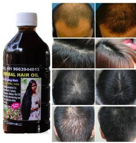 Adivasi yurvedic strong roots oil, privents hair fall good for hair growth Hair Oil