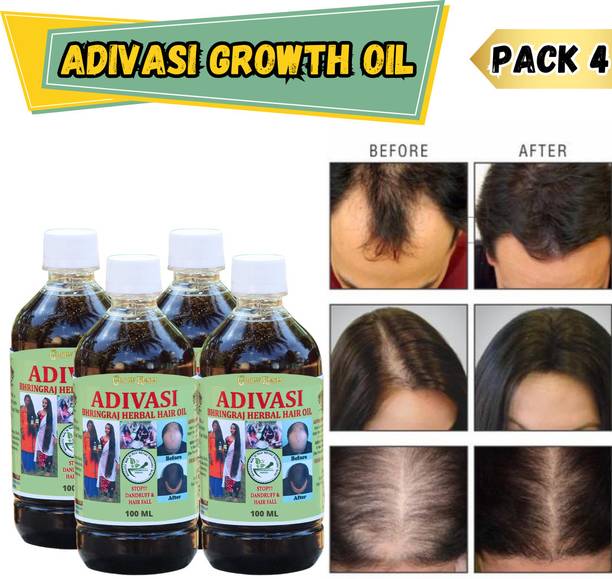 Growkesh Ayurvedic Hair Oil for Growth and Hair Fall Control Hair Oil