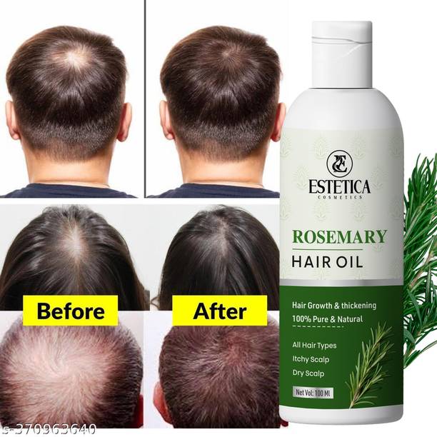 Estetica Rosemary Hair Oil for Hair Fall Control & Hair Nourishment Hair Oil