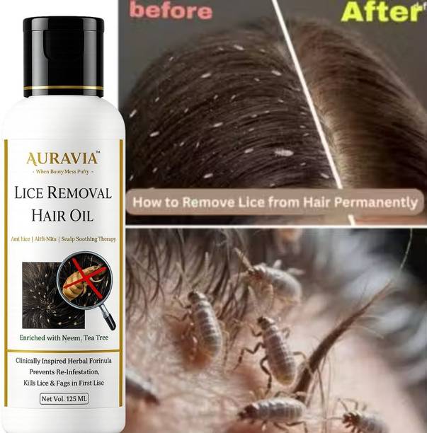 AURAVIA Hair Oil for Healthy Scalp and Lice Prevention | 125ml Hair Oil