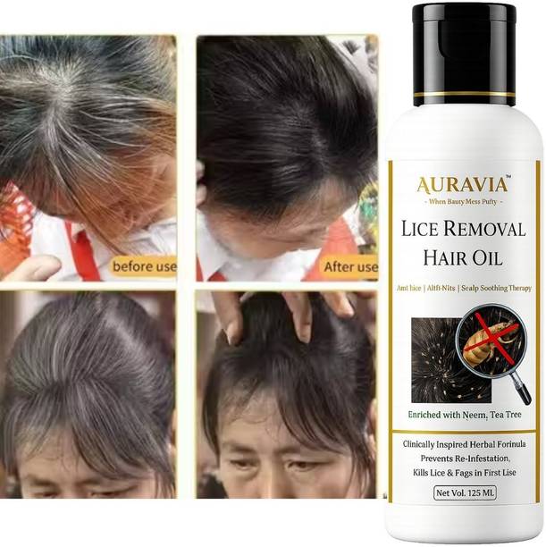 AURAVIA Lice & Nits Care Hair Oil for Healthy Looking Hair Hair Oil