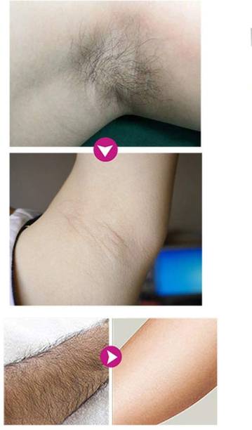 Emijun Intimate/Private Hair Removal Cream for Men or women for Unwanted Cream