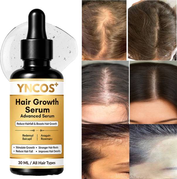 YNCOS A Advanced Hair Growth Serum - Redensyl, Rosemary, Anagain, Biotin | Women & Men
