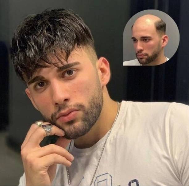 Growth Medium Hair Wig