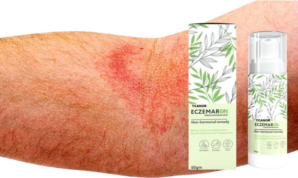 TCANOR HARBAL Eczemaron Anti Fungal Cream For Men & Women /-1