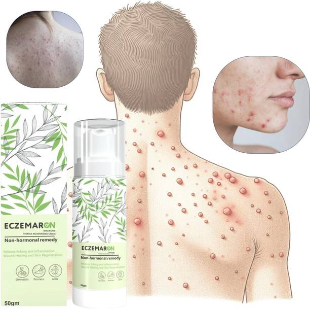 Eczemaron Ringworm Anti Fungal Cream For Men & Women.