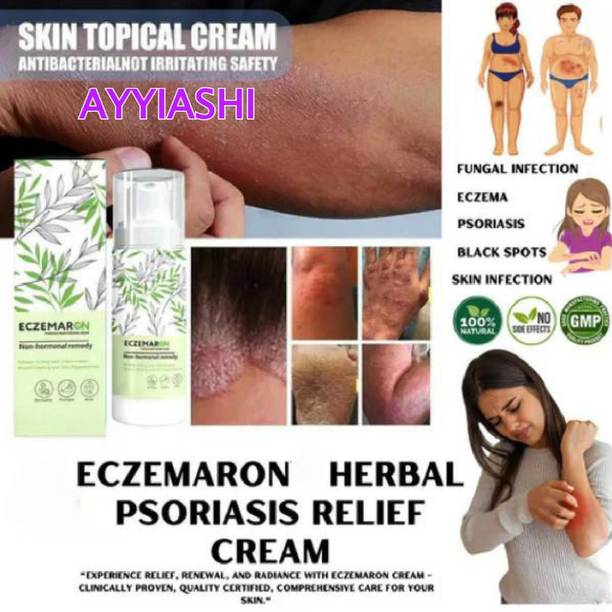 AYYIASHI Herbal Antifungal Cream Eczemaron No Side Effect Daily Use