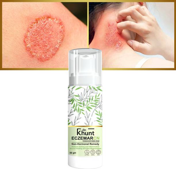 Dr.Khunt Eczemaronn Anti Fungal Cream For Men & Women