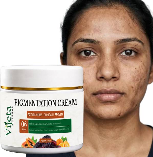 7 Days Herbal Pigmentation Care Cream