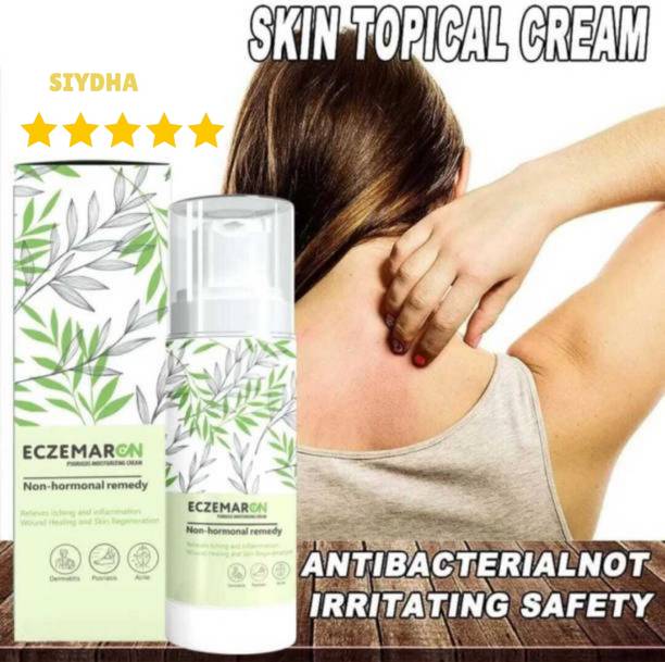 SIYDHA Lightweight Eczemaron Anti Fungal Cream For Everyday Use