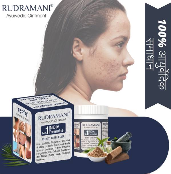 Rudramani Eczemaran anti fungal Powerful Anti-Fungal Relief Ointment