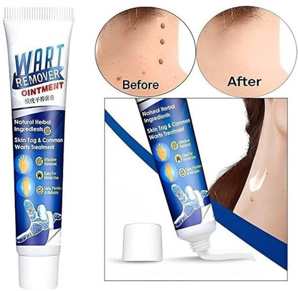femoz Wart remover ointment Natural Body Painlessly Wart remover women (1x50gm)