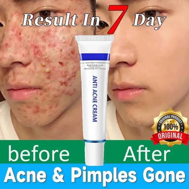 GULGLOW99 Dark Spot Remover Cream, Pimple Marks, Acne Scar, Pigmentation