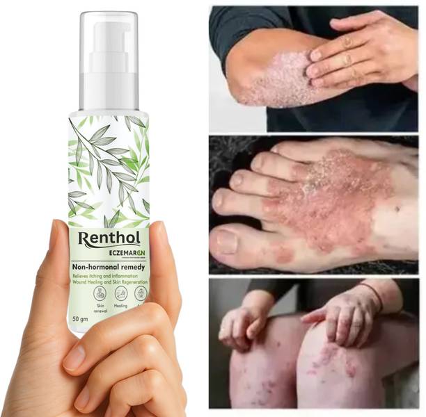 Renthol Eczemaron Anti Fungal Cream For Men & Women ItchCoat-Eczema cream (Pack of -1)