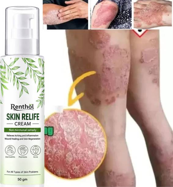 Renthol Skin Relife Ayurvedic Anti Fungal Cream | Ringworm & Eczema Relief | 50g