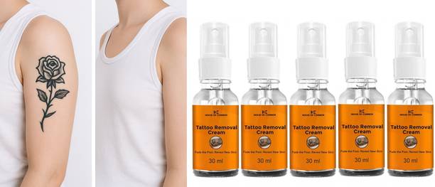 house of common Natural Tattoo Removal Cream for Men & Women (30ml) Pack of 5