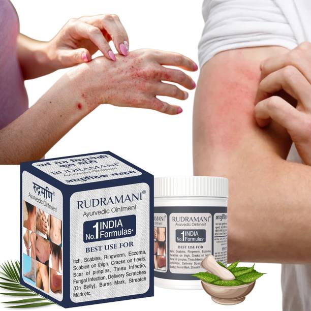 Rudramani Eczemaran Ringworm Anti Fungal Skin Infection Ointment