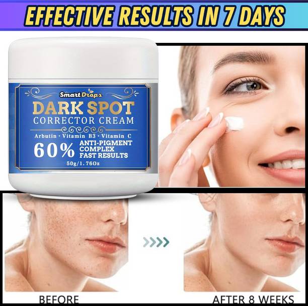 smartdrops Dark Spot Removal ||Reduce Dark Spot ||Pigmentation & Radiance Glow Cream
