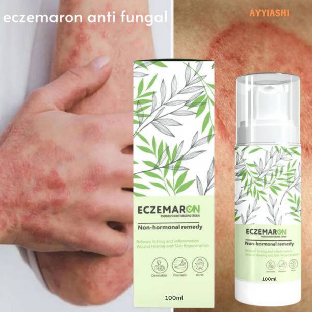 AYYIASHI Eczemaron Quick Relief Anti-fungal Cream For Irritated Skin