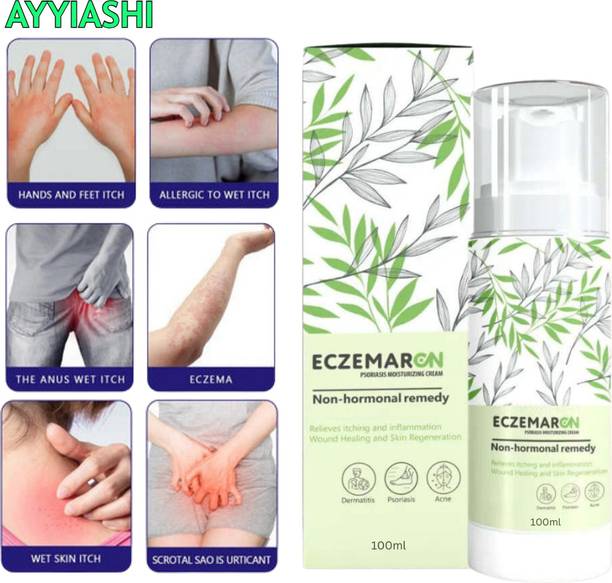 AYYIASHI Herbal Antifungal Cream Eczemaron Safe Effective Solution