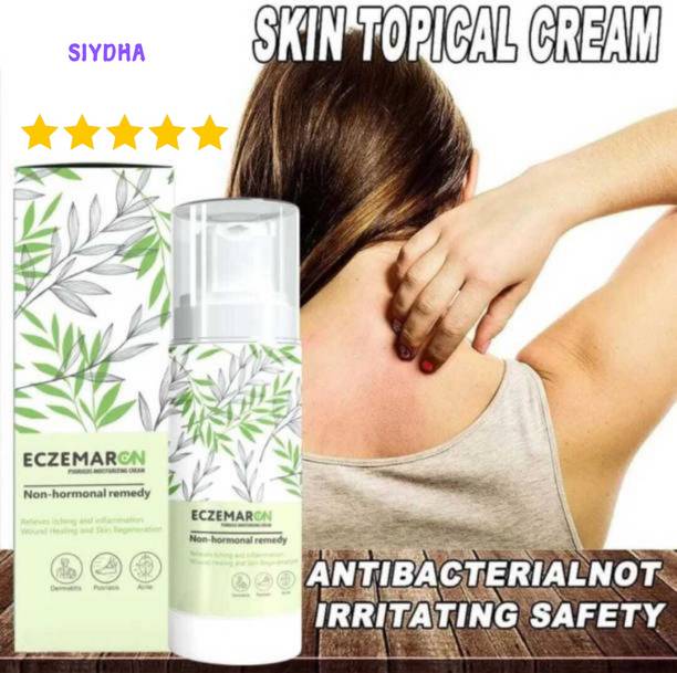 SIYDHA Eczemarcn Anti Fungal Cream Offers Rapid Healing For Fungal Infection