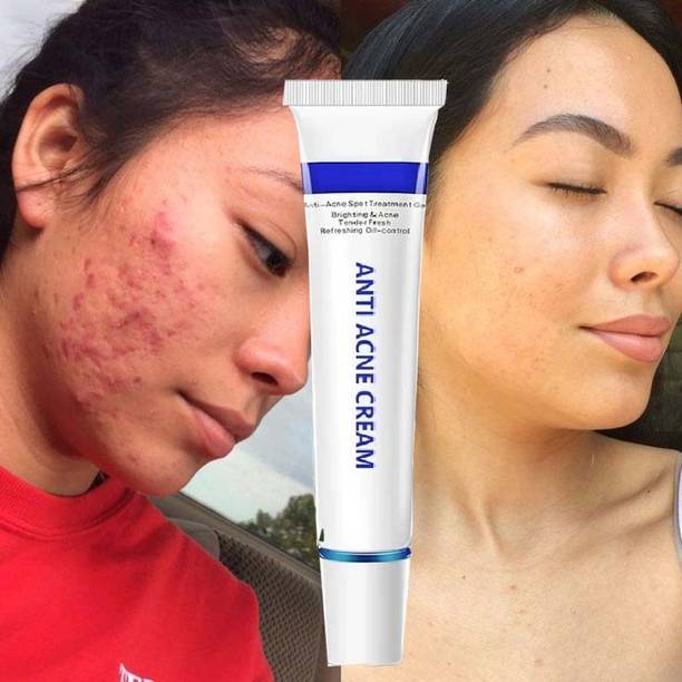 manasona Natural Dark Spot Remover Cream For Remove Pimple Marks | Acne Scar