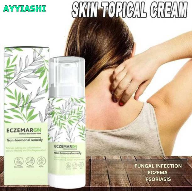 AYYIASHI Eczemaron Antifungal Cream Safe Herbal Natural Skin Recovery