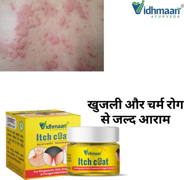 vidhmaan ayurveda itchcoat Itching Treatment Malam & Ointment