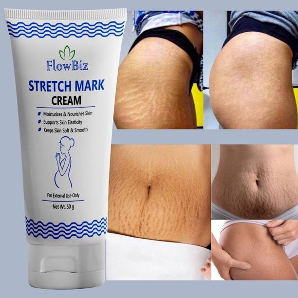 FlowBiz Gentle Stretch Mark Cream VIYANSHENTERPRISE1810