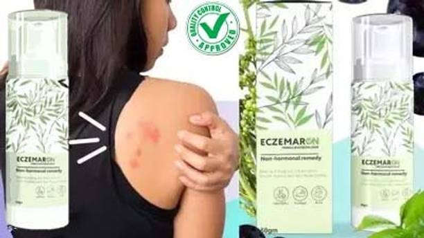 REGLET Fungal Cream For Men & Women Ayurvedic ItchCoat Anti fungal for Ringworm